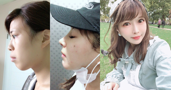 私が700万円をかけて美容整形をした理由