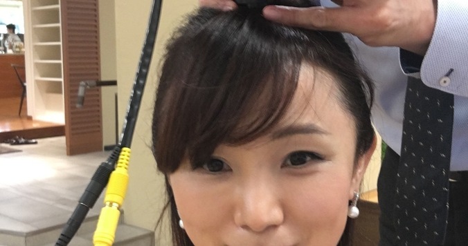 【部活BLOG】アンチエイジングの鍵は毛細血管。血管年齢の分かれ道は45歳WE.WHITE.EXPERIENCE