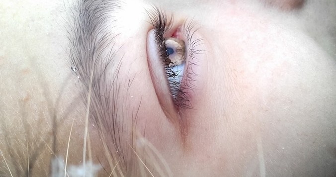 「水光注射」とは？どんな効果がある？個人的な体験談【医師の解説付き】