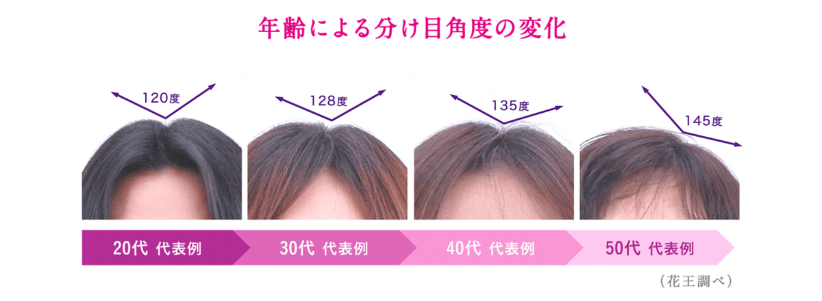 コンプリート 紫の髪 紫の髪 芸能人 Saikonoeventsmuryogazo