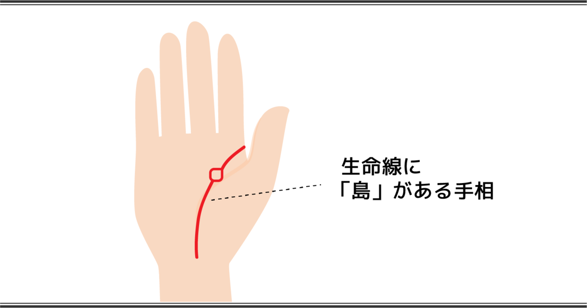 生命線の見方 島のある手相