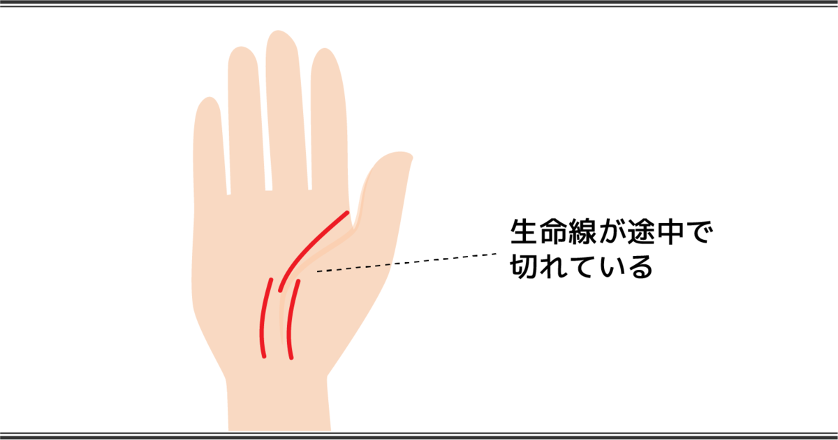 生命線が途中で切れている手相