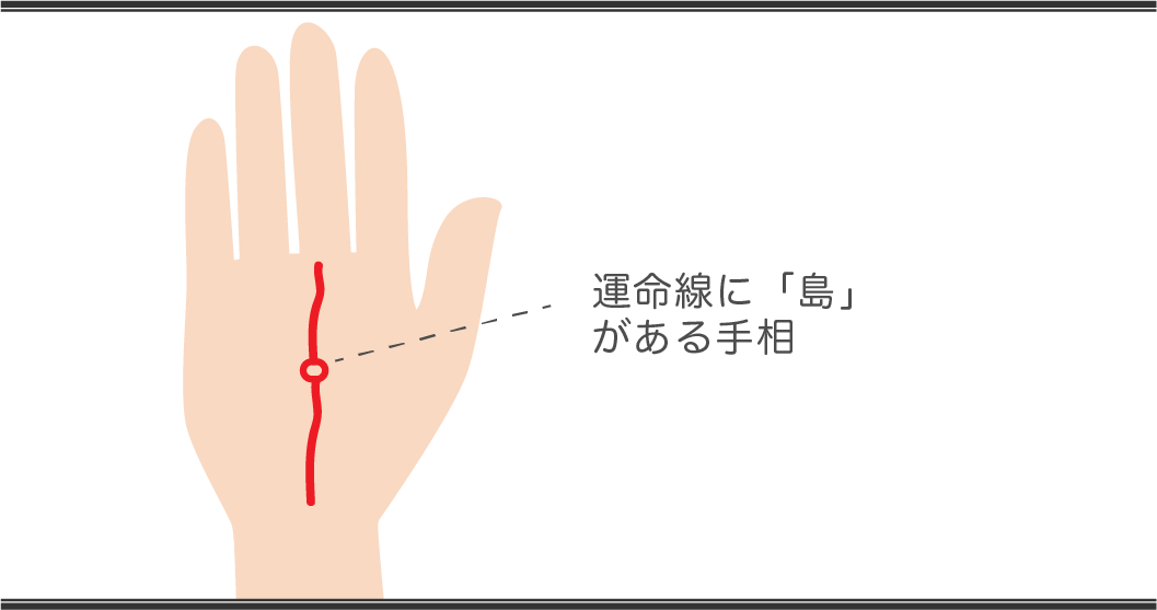 運命線の見方 島がある手相