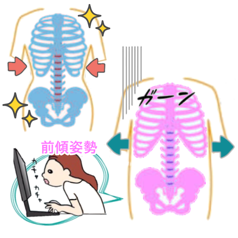 前傾姿勢が悪い女性